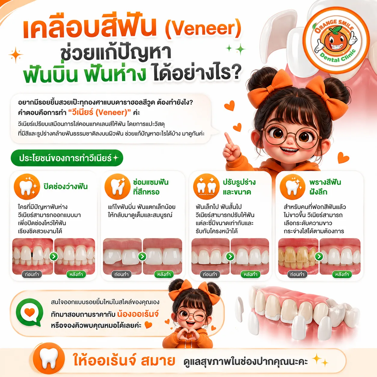 วีเนียร์คืออะไร เหมาะกับใคร และอยู่ได้นานแค่ไหน