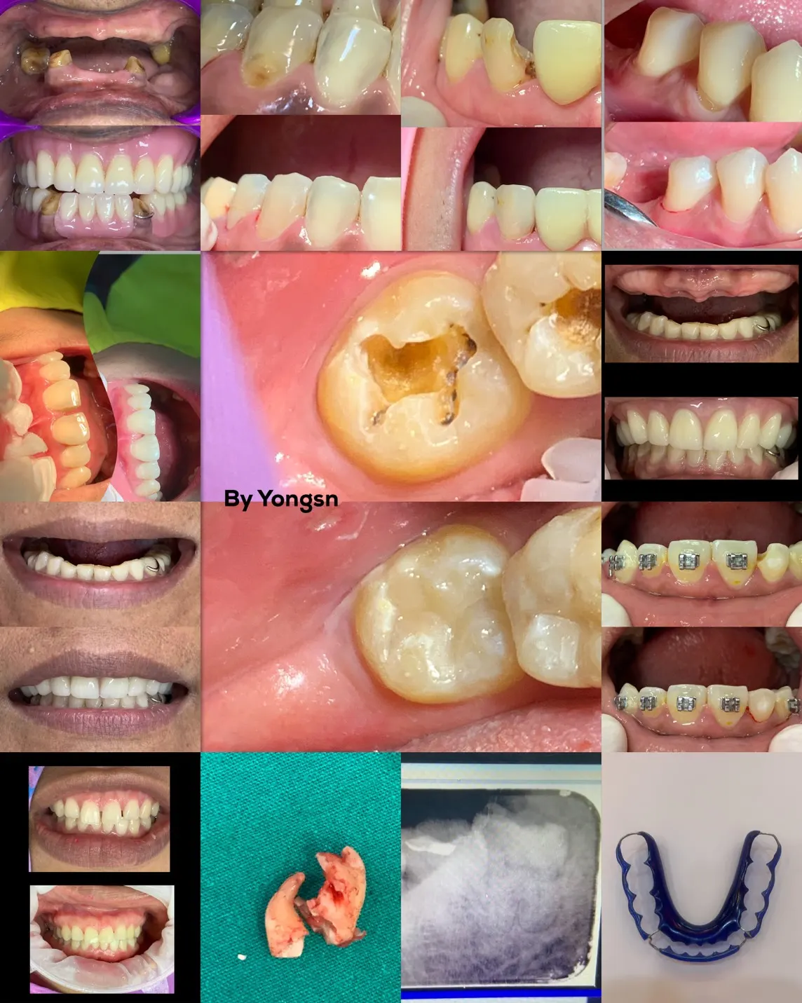 รีวิวรวมเคส